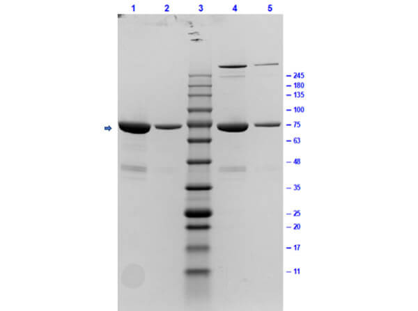 SDS-PAGE Results of p35 Control Protein