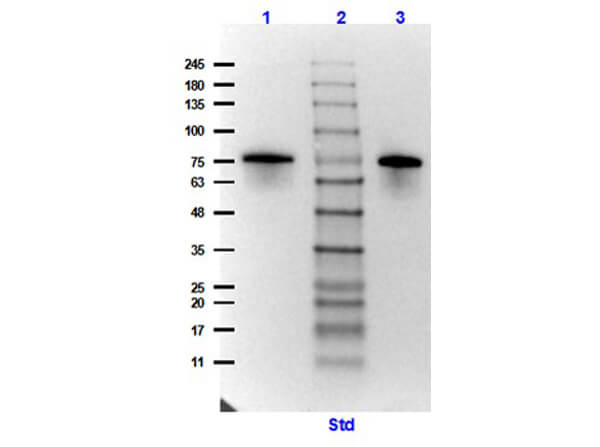Western Blot Results of Surface Lipoprotein p27 Control Protein