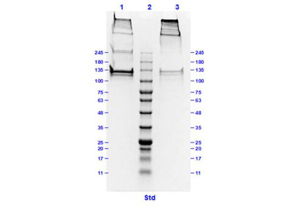 SDS PAGE Results of Bovine Collagen Type I