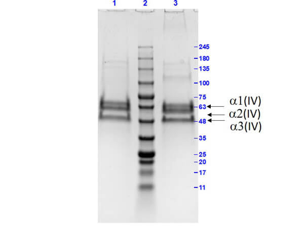 SDS-PAGE of Bovine Collagen Type IV