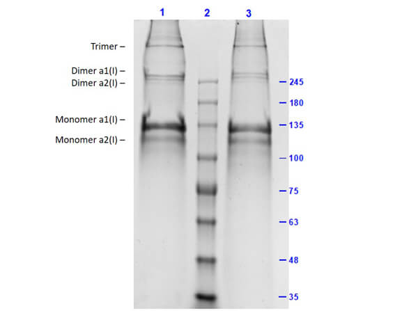 SDS-PAGE Results of Human Collagen Type I
