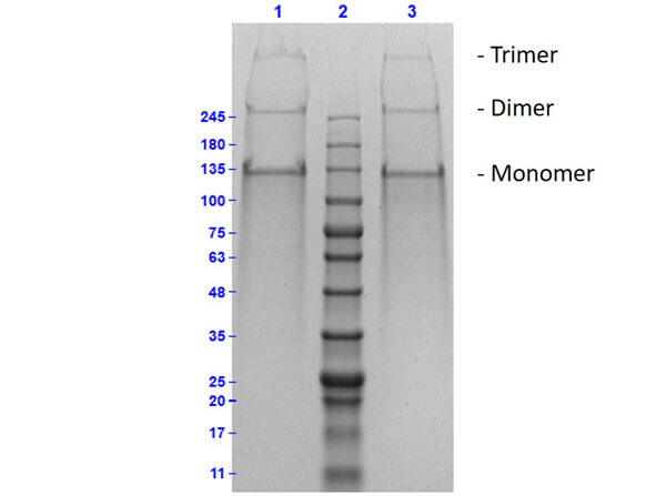 SDS PAGE Results of human Collagen Type II