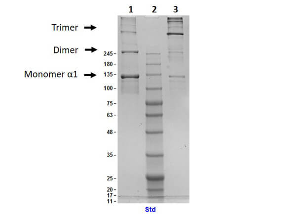 SDS-PAGE Results of Human Collagen Type III