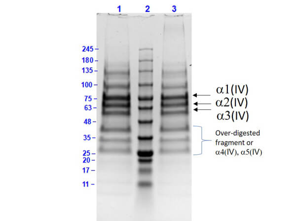 SDS-PAGE Results of Human Collagen Type IV