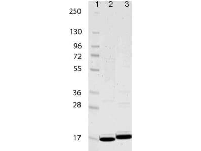 IL-1 Beta Human Recombinant Protein