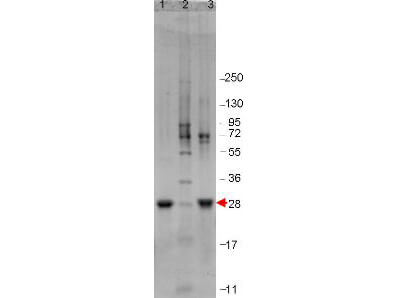IL-6 Human Recombinant Protein
