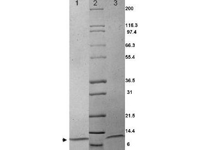 MIP-1 alpha Human Recombinant Protein