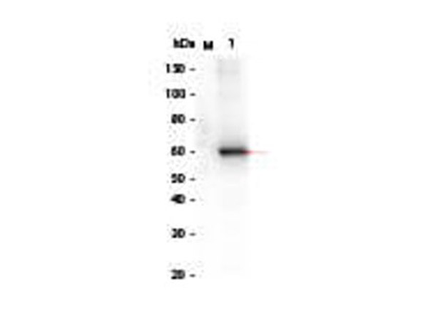AKT2_phosphatase_treated_Human_Recombinant_Protein Western Blot