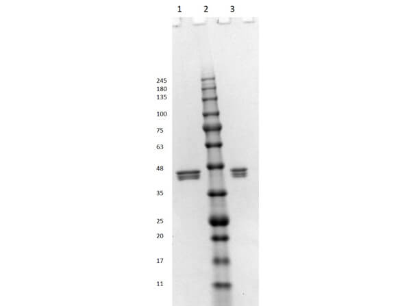 SDS PAGE Results of  ERK1 human recombinant protein