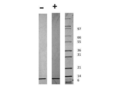 SDS-PAGE of Human Beta-cell Attracting Chemokine 1 (CXCL13) Recombinant Protein