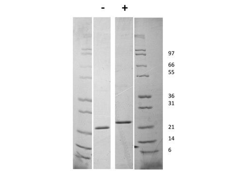 SDS-PAGE of Human Fibroblast Growth Factor-21 Recombinant Protein
