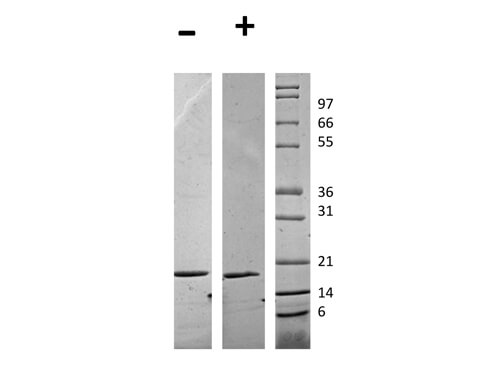 SDS-PAGE of Human Flt-3 Ligand Recombinant Protein