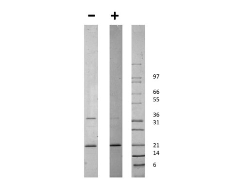 rHuman globular ACRP-30 Protein
