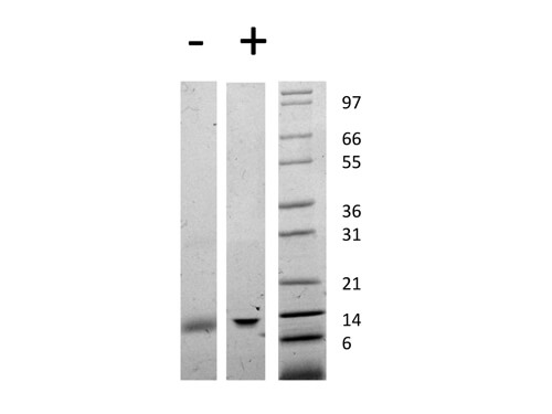 rHuman Galectin-1 Protein