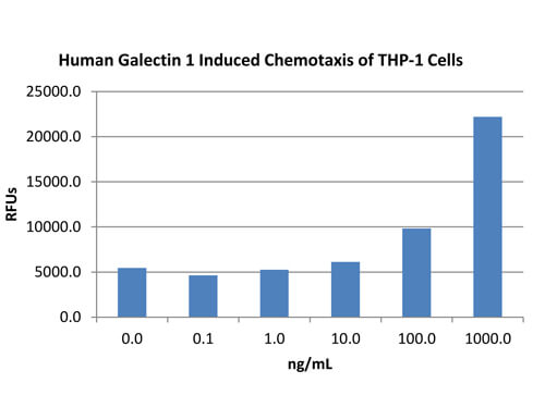 SDS-PAGE of Human Galectin-1 Recombinant Protein