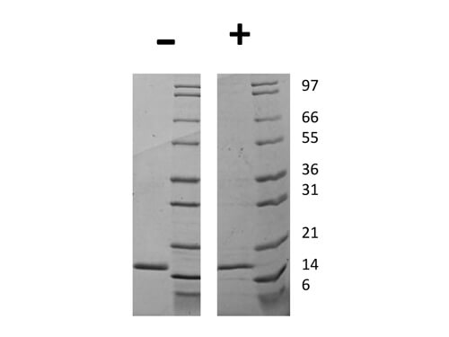 rHuman G-CSF Protein