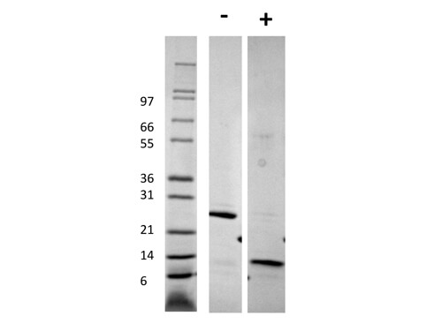 SDS-PAGE of Human Growth and Differentiation Factor-5 Recombinant Protein