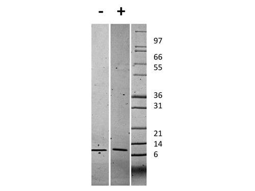 SDS-PAGE of Human Gro Alpha (CXCL1) Recombinant Protein