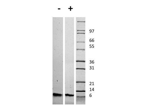 SDS-PAGE of Human Insulin-like Growth Factor I Recombinant Protein