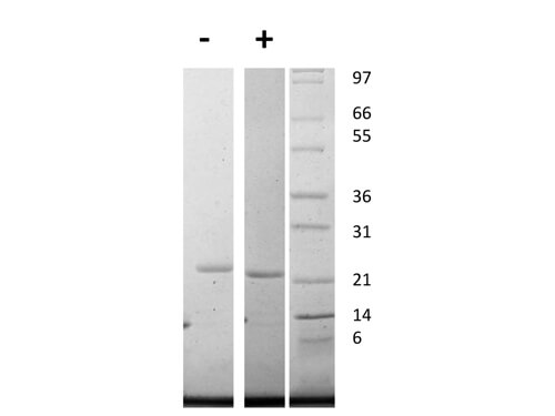 SDS-PAGE of Human Interleukin-11 Recombinant Protein