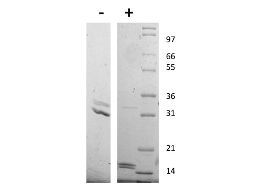 SDS-PAGE of Human Interleukin-17AF Heterodimer Recombinant Protein