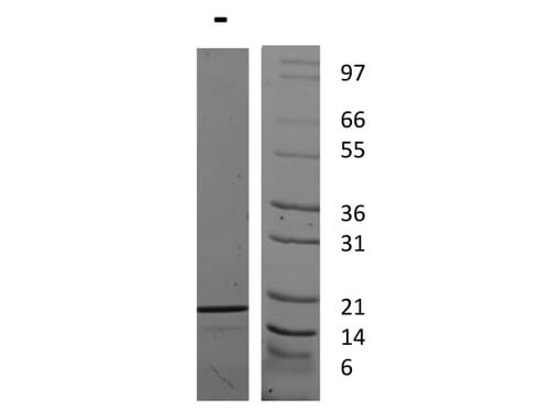 SDS-PAGE of Human Interleukin-19 Recombinant Protein