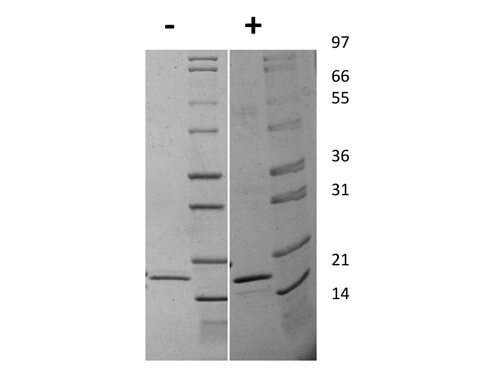 SDS-PAGE of Human Interleukin-20 Recombinant Protein