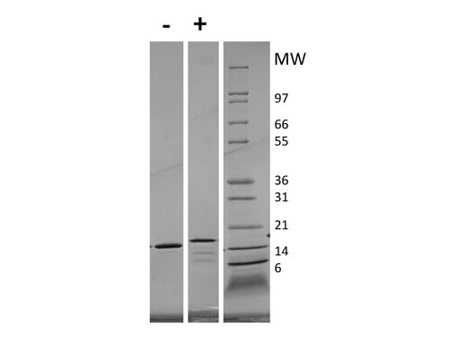 SDS-PAGE of Human Interleukin-21 Recombinant Protein (Animal Free)