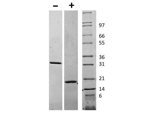 rHuman M-CSF Protein
