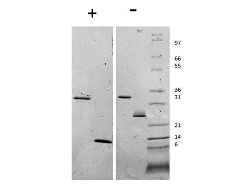 SDS-PAGE of Human Myostatin Propeptide Recombinant Protein