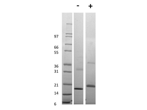 SDS-PAGE of Human Tumor Necrosis Factor Receptor Type 1 Recombinant Protein