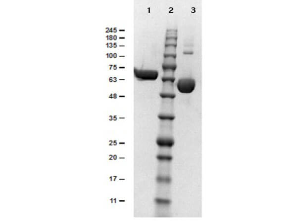 SDS-PAGE results of Human Albumin