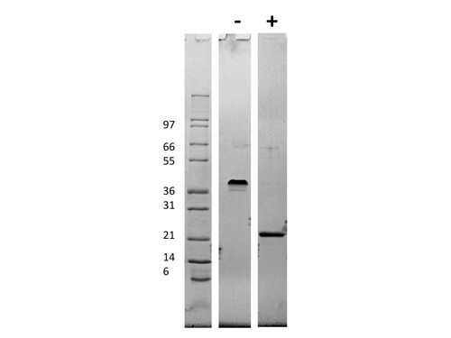 SDS-PAGE of Mouse Vascular Endothelial Growth Factor-165 Recombinant Protein