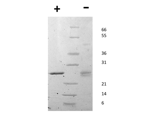 SDS-PAGE of Human Mouse Epstein-Barr Virus Induced Gene 3 Recombinant Protein