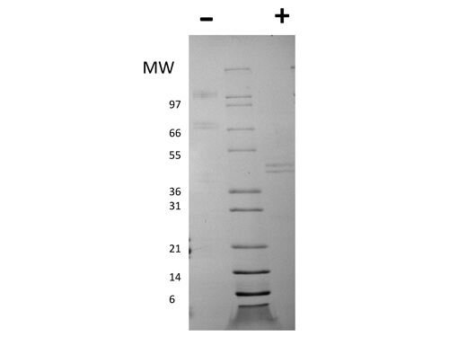 SDS-PAGE of Mouse Interleukin-12 Recombinant Protein