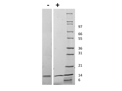 rMouse IL-31 Protein