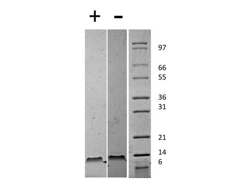 SDS-PAGE of Mouse Stromal Cell-Derived Factor-1 beta (CXCL12) Recombinant Protein