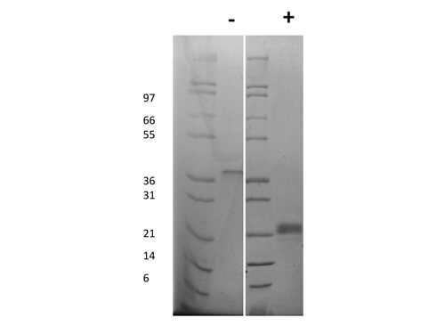 SDS-PAGE of Rat Vascular Endothelial Growth Factor-165 Recombinant Protein