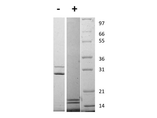 SDS-PAGE of Rat Interleukin-17AF Heterodimer Recombinant Protein