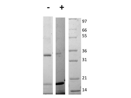 SDS-PAGE of Rat Interleukin-17E (IL-25) Recombinant Protein