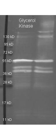 Glycerol Kinase Polyclonal Antibody-Western blot