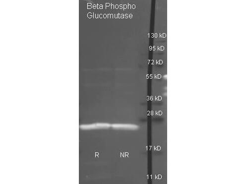 Beta Phospho Glucomutase Polyclonal Antibody-Western blot