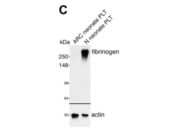 Western Blot using Fibrinogen