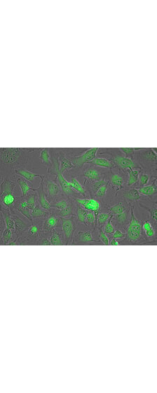 Rockland Lactate Dehydrogenase Antibody-Immunofluorescence