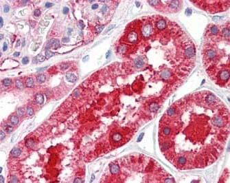 Anti-Ferritin Antibody - Immunohistochemistry