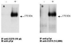 Immunoprecipitation/Western Blot - Anti-EGFR Antibody