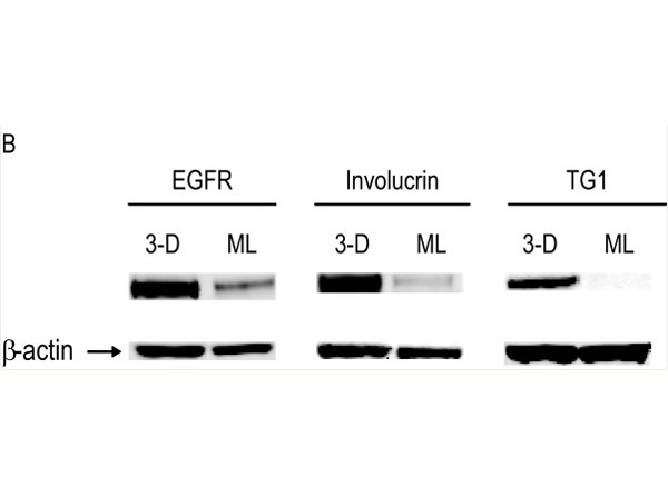 Western Blot using EGFR