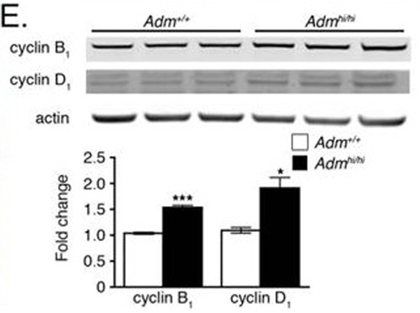 Western Blot using Cyclin D1