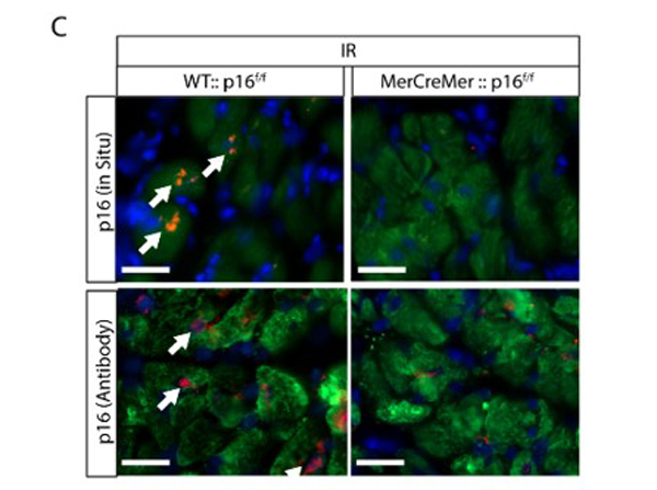 Assay of p16 antibody specificity.