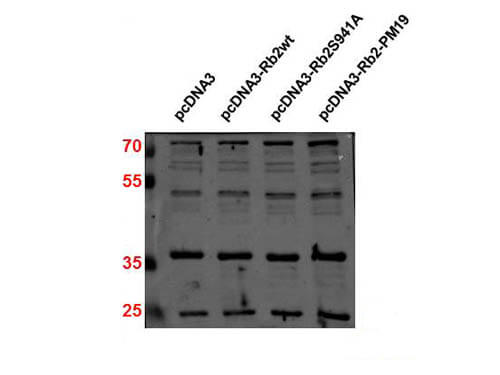 Western Blot of Rabbit anti-p27 antibody